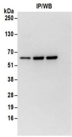 ZNF622 Antibody, Novus Biologicals 0.1mg; Unlabeled:Antibodies, Polyclonal