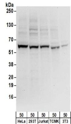ZNF622 Antibody, Novus Biologicals 0.1mg; Unlabeled:Antibodies, Polyclonal