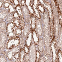ZNF623 Antibody, Novus Biologicals:Antibodies:Primary Antibodies