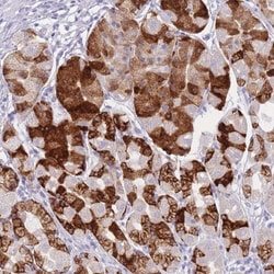 ZNF627 Antibody, Novus Biologicals:Antibodies:Primary Antibodies