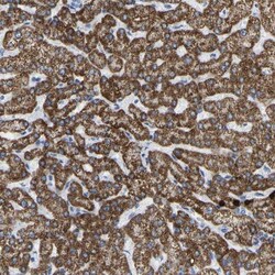 ZNF629 Antibody, Novus Biologicals:Antibodies:Primary Antibodies