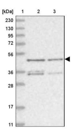 ZNF641 Antibody, Novus Biologicals 0.1mL; Unlabeled:Antibodies, Polyclonal