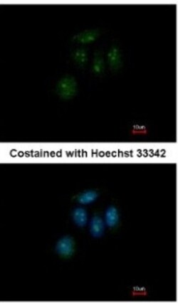 ZNF642 Antibody, Novus Biologicals 0.1 mL | Buy Online | Novus Biologicals | Fisher Scientific
