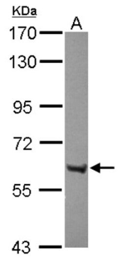 ZNF642 Antibody, Novus Biologicals 0.1 mL | Buy Online | Novus Biologicals | Fisher Scientific