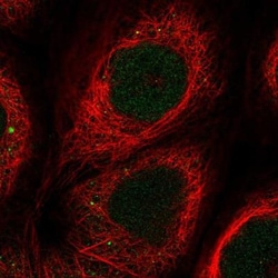 ZNF643 Antibody, Novus Biologicals 25 &mu;L | Buy Online | Novus Biologicals | Fisher Scientific