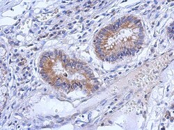ZNF645 Antibody, Novus Biologicals 0.1mL; Unlabeled:Antibodies, Polyclonal