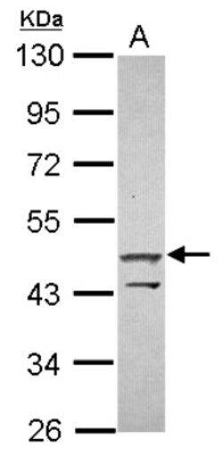 ZNF645 Antibody, Novus Biologicals 0.1mL; Unlabeled:Antibodies, Polyclonal