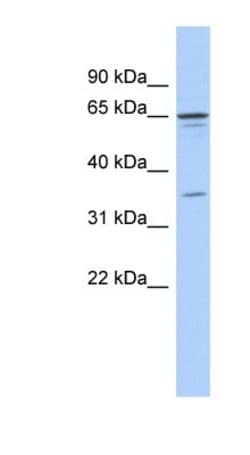 ZNF648 Antibody, Novus Biologicals 100 &mu;L | Buy Online | Novus Biologicals | Fisher Scientific