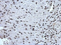 ZNF649 Antibody, Novus Biologicals 0.1mL; Unlabeled:Antibodies, Polyclonal