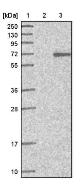 ZNF649 Antibody, Novus Biologicals 25 &mu;L; Unlabeled:Antibodies, Polyclonal