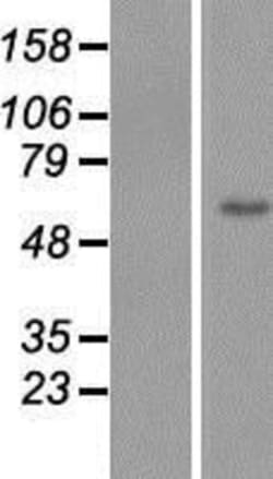Novus Biologicals&trade;&nbsp;ZNF649 Overexpression Lysate