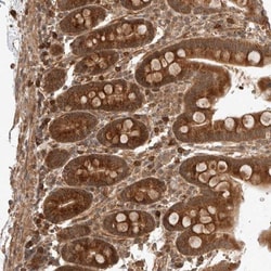ZNF649 Antibody, Novus Biologicals 25 &mu;L; Unlabeled:Antibodies, Polyclonal