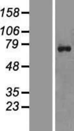 Novus Biologicals&trade;&nbsp;ZNF652 Overexpression Lysate