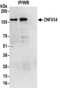 ZNF654 Antibody, Novus Biologicals 0.1mg; Unlabeled:Antibodies, Polyclonal