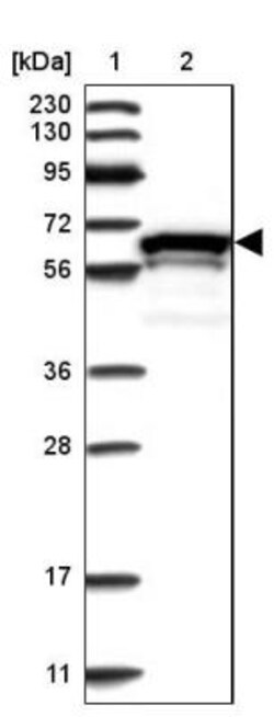 ZNF655 Antibody, Novus Biologicals 25 &mu;L; Unlabeled:Antibodies, Polyclonal