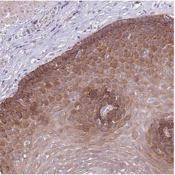 ZNF658 Antibody, Novus Biologicals:Antibodies:Primary Antibodies