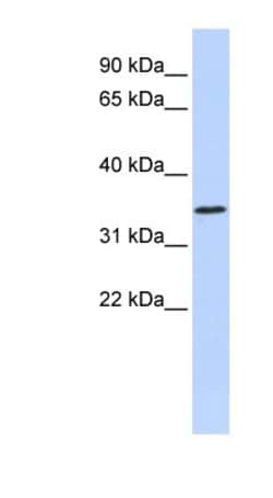 ZNF660 Antibody, Novus Biologicals 100 &mu;L | Buy Online | Novus Biologicals | Fisher Scientific
