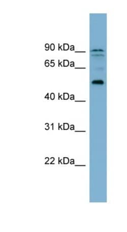 ZNF662 Antibody, Novus Biologicals:Antibodies:Primary Antibodies