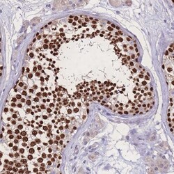 ZNF662 Antibody, Novus Biologicals 0.1mL; Unlabeled:Antibodies, Polyclonal