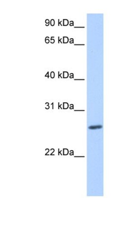 ZNF664 Antibody, Novus Biologicals 100&mu;L; Unlabeled:Antibodies, Polyclonal