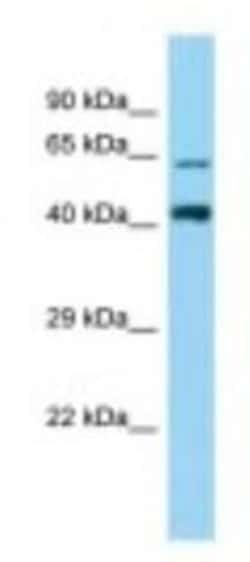 ZNF667 Antibody, Novus Biologicals 100&mu;L; Unlabeled:Antibodies, Polyclonal