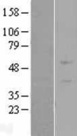 Novus Biologicals™ ZNF669 Overexpression Lysate