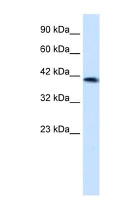 ZNF670 Antibody, Novus Biologicals™