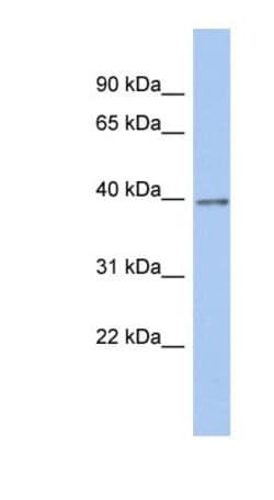 ZNF670 Antibody, Novus Biologicals™