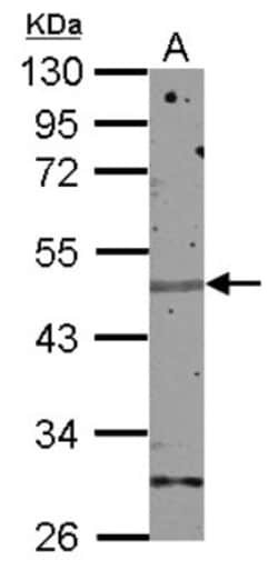 ZNF672 Antibody, Novus Biologicals 0.1mL; Unlabeled:Antibodies, Polyclonal