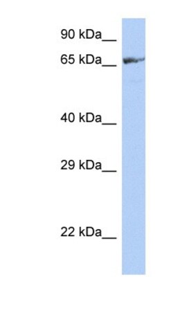 ZNF676 Antibody, Novus Biologicals 100&mu;L; Unlabeled:Antibodies, Polyclonal