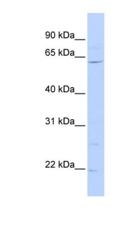 ZNF680 Antibody, Novus Biologicals™