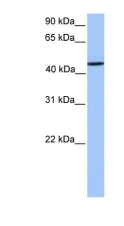 ZNF680 Antibody, Novus Biologicals™
