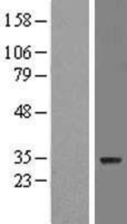 Novus Biologicals&trade;&nbsp;ZNF688 Overexpression Lysate