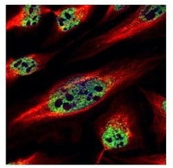 ZNF689 Antibody, Novus Biologicals 0.1mL; Unlabeled:Antibodies, Polyclonal