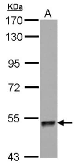 ZNF689 Antibody, Novus Biologicals 0.1mL; Unlabeled:Antibodies, Polyclonal