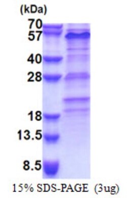 Novus Biologicals&trade;&nbsp;Recombinant Human ZNF689 His Protein
