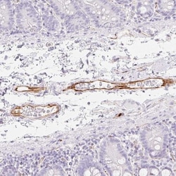 ZNF689 Antibody, Novus Biologicals:Antibodies:Primary Antibodies