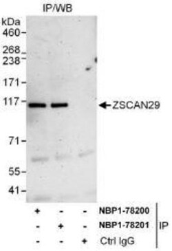 ZNF690 Antibody, Novus Biologicals 0.1mg; Unlabeled:Antibodies, Polyclonal
