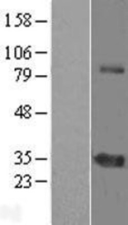 Novus Biologicals™ ZNF691 Overexpression Lysate