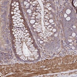 ZNF696 Antibody, Novus Biologicals 25 &mu;L, Unlabeled:Antibodies, Polyclonal