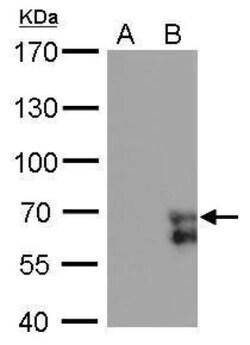 ZNF703 Antibody (372), Novus Biologicals 0.1mL; Unlabeled:Antibodies, Monoclonal