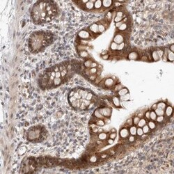 ZNF704 Antibody, Novus Biologicals 0.1mL; Unlabeled:Antibodies, Polyclonal