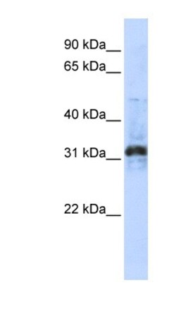 ZNF705D Antibody, Novus Biologicals 100&mu;L; Unlabeled:Antibodies, Polyclonal