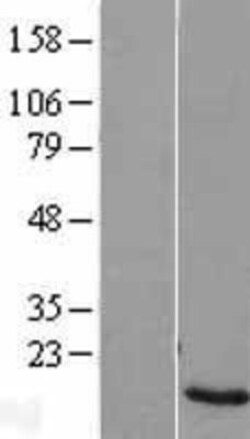 Novus Biologicals&trade;&nbsp;ZNF706 Overexpression Lysate