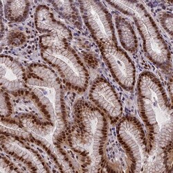 ZNF707 Antibody, Novus Biologicals 25 &mu;L, Unlabeled:Antibodies, Polyclonal