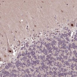 ZNF709 Antibody, Novus Biologicals 25 μL, Unlabeled:Antibodies, Polyclonal