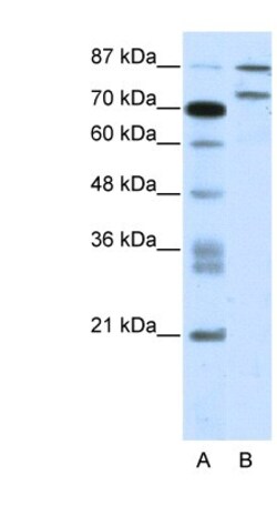 ZNF709 Antibody, Novus Biologicals 100&mu;L; Unlabeled:Antibodies, Polyclonal
