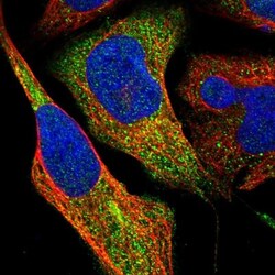 ZNF70 Antibody, Novus Biologicals:Antibodies:Primary Antibodies