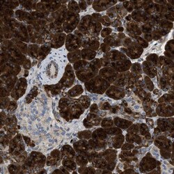 ZNF70 Antibody, Novus Biologicals:Antibodies:Primary Antibodies