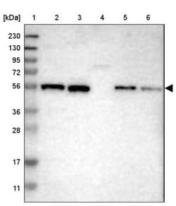 ZNF70 Antibody, Novus Biologicals:Antibodies:Primary Antibodies